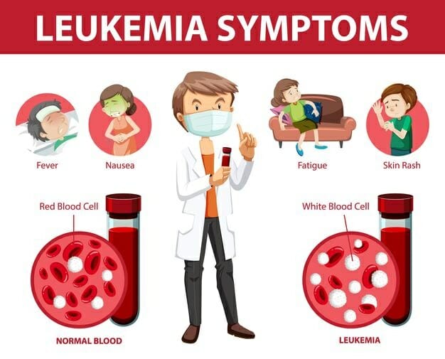 Symptoms Of Leukemia In Adults