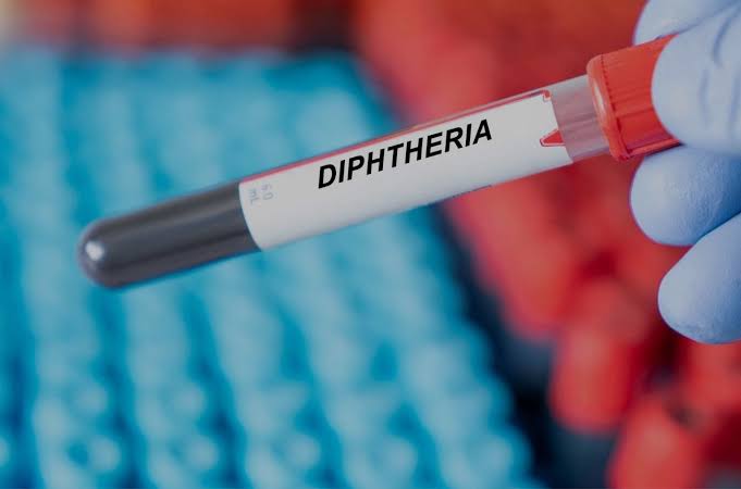Diphtheria outbreak in Kaduna