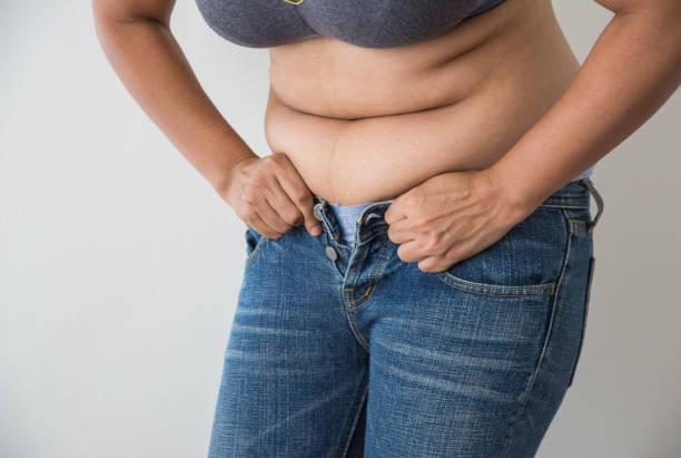 How to Get Rid of Hormonal Belly Fat
