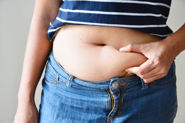 How to Get Rid of Hormonal Belly Fat