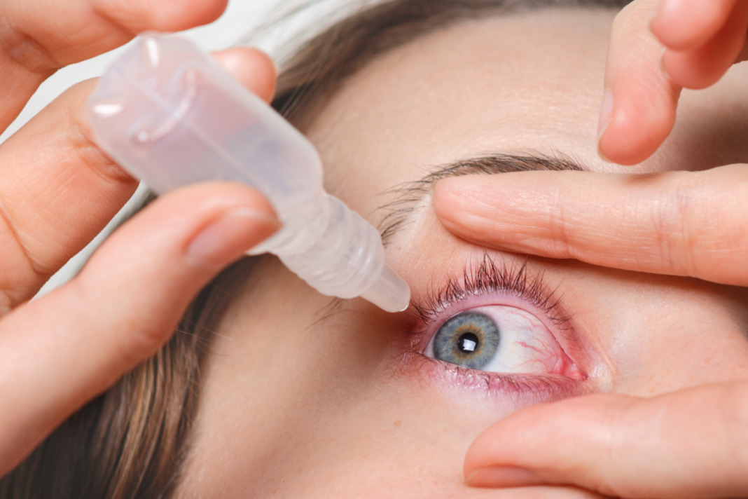 How To Treat Pink Eye