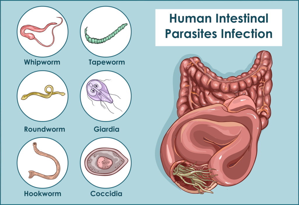 Signs You Have Got Parasite